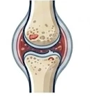 Osteoarthritis management icon