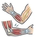 Wrist and elbow pain treatment icon